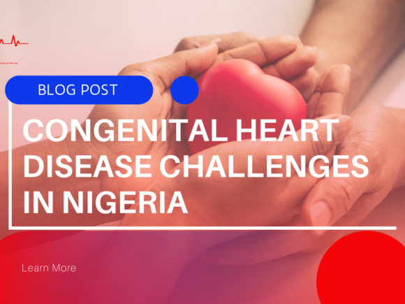 Congenital Heart Disease Challenges in Nigeria